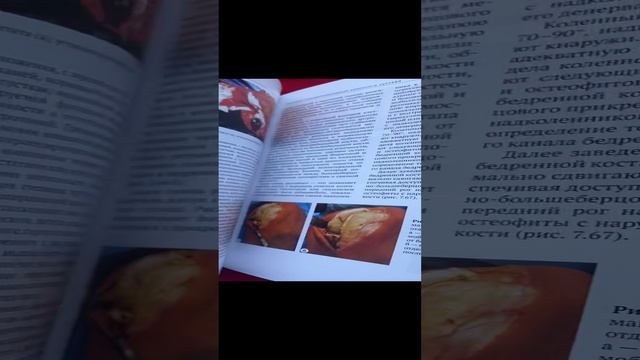 Руководство по первичному эндопротезированию коленного сустава. Второе издание, исправленное и допол