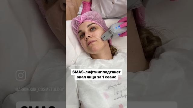СМАС лифтинг лица в Москве, салон Абрикосик