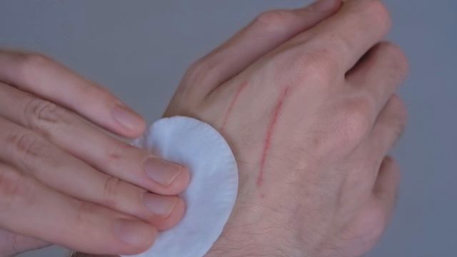 ЭТО происходит за ДВА сеанса! Перекись водорода на стопы.