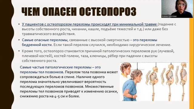 Особенности питания при остеопорозе