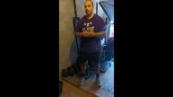 Upper Bicep Tendon Rupture recovery video one.
