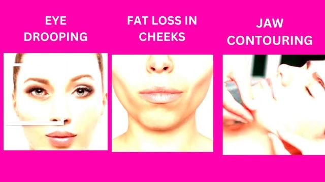 Everything About Anti-Aging Treatment, Thread Lift Treatment | What is Thread Face Lift?