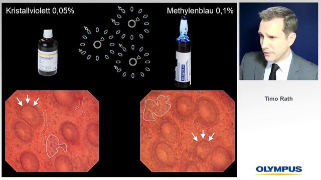 Endoclubnord 2020: Endoskopie Symposium zu neuen Technologien in der klinischen Praxis