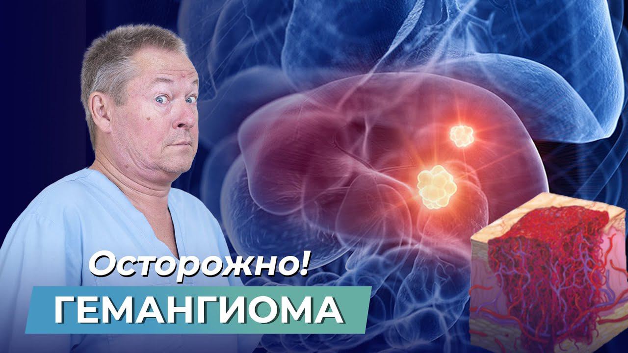 Осторожно! Нужно ли УДАЛЯТЬ ГЕМАНГИОМУ?