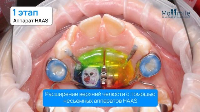 МосСмайл. Детская ортодонтия
