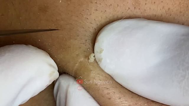 Satisfying And Relaxation With SURI NGUYEN Beauty Spa Video #399