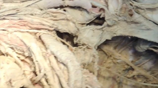 Образование спинномозговых нервов, их передние и задние ветви. Шейное сплетение и его ветви