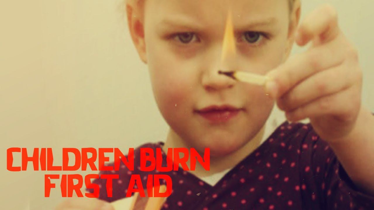 Children First Aid  Burns