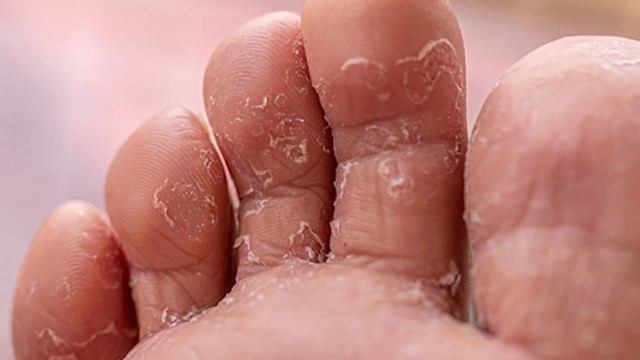 Что творит ХОЗЯЙСТВЕННОЕ МЫЛО? Врачи Сами так Делают и Скрывают ЭТО...