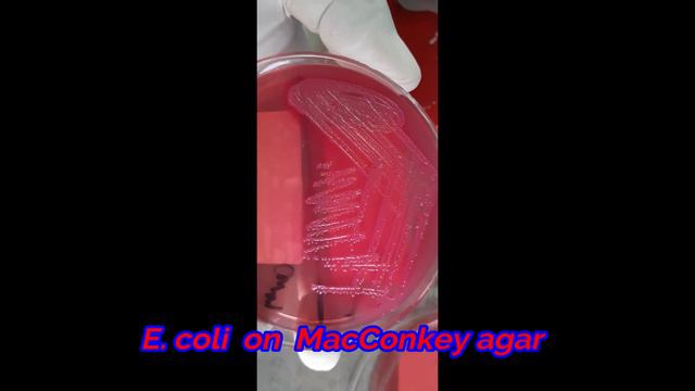 Staphylococcus aureus , E  coli and Klebsiella penumoniae on growth on various media