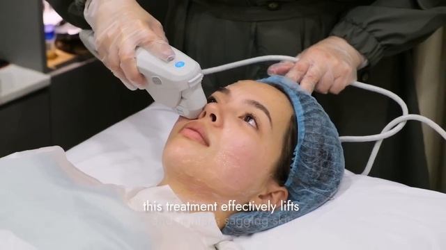 Julia Montes tries Avignon Ulthera Ultimate Lift