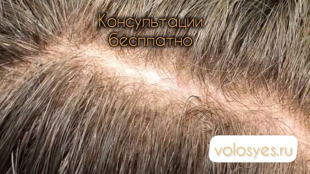 Консультация система волос «volosyes.ru"