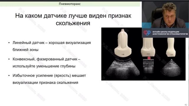 Прикроватная ультразвуковая диагностика в ургентных ситуациях