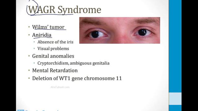 Renal - 5. Other Renal Topics - 5.Renal and Bladder Tumors atf
