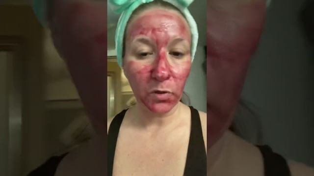 The Ordinary Chemical Peel  10minute Exfoliating Facial
