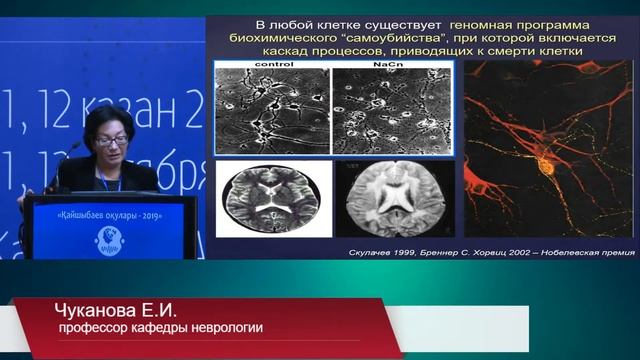 Патогенетические основы терапии хронической цереброваскулярной недостаточности