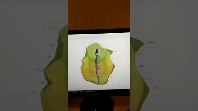Диагностика Кристалл в прямом эфире