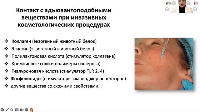 Ревмозаболевания и косметические процедуры-что можно?. .mp4