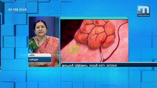 Excessive Uterine Bleeding: Causes And Treatment| Doctor @2PM| Mathrubhumi News