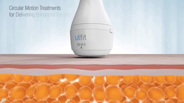 Ulfit - ультразвук для стройности тела