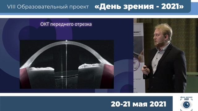 Круглый стол. Оптическая когерентная томография при миопии. От переднего до заднего отрезка