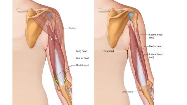 Triceps Brachii   Drawn Figure Attachments   Muscle Anatomy Master Class