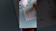 Определение группы крови и резус фактора с использованием цоликлонов