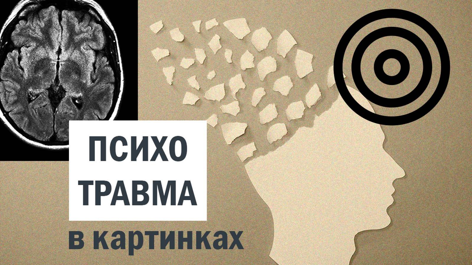 Как травмируется психика | История в картинках