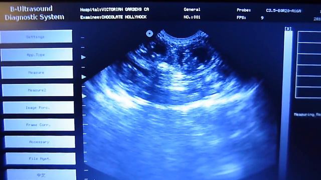 Amazing Ultrasound Video of Holly's Persian & Himalayan Babies Moving In Her Womb