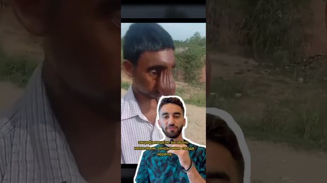 мозг снаружи черепа