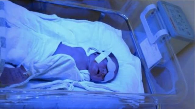 ретинопатия недоношенных лазерокоагуляция Retinopathy of prematurity retinal laser coagulation