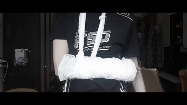 Сломал Руку на Эксперименте!