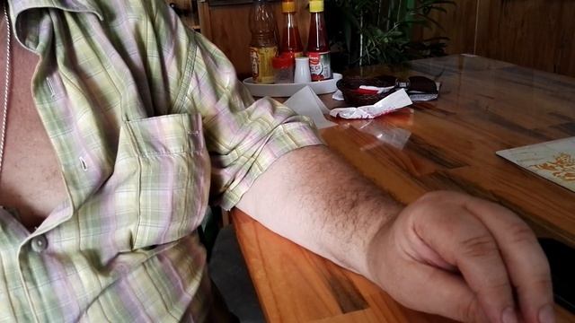 Иглоукалывание. Рассказ довольного пациента. 10B Vo Thi Sau. Nha Trang