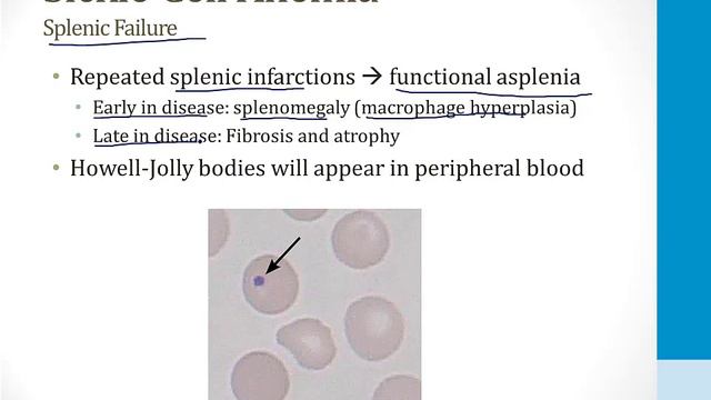 Hematology - 2. Red Blood Cells - 6.Sickle Cell Anemia atf