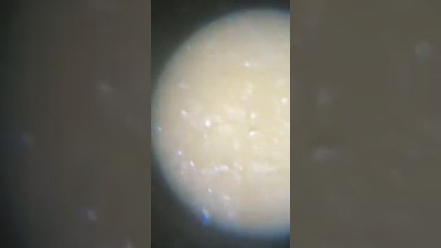 Вот как выглядит банан под микроскопом/What does food look like under a microscope