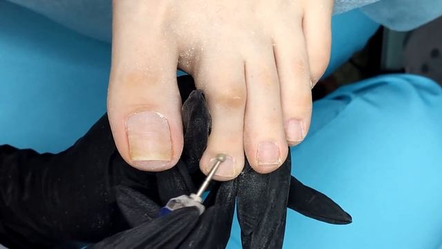 АППАРАТНЫЙ ПЕДИКЮР. Покрытие гель-лаком YMMY Professional. Nail design. Pedicure. Hardware pedicure
