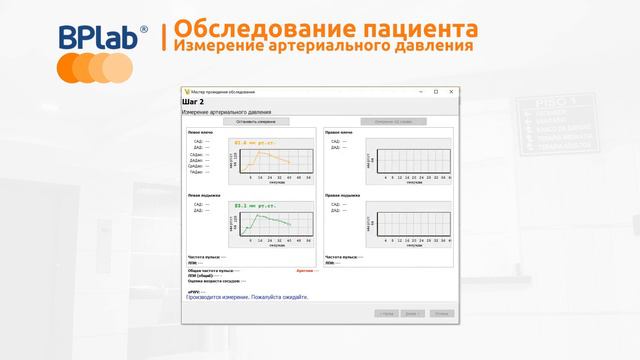 Видеоинструкция BPlab Angio_рус