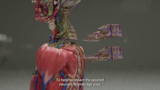 Представяне на роботизирана система с ИИ за трансплантация на глава.