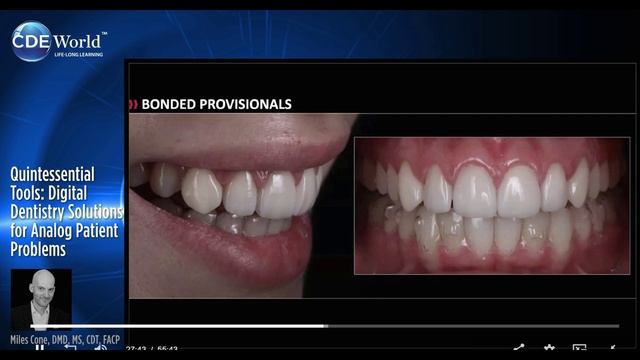Цифровые стоматологические решения для решения аналоговых проблем пациентов.Miles Cone, DMD, MS, CDT