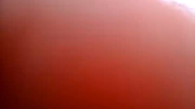 Упала с детской горки мво
