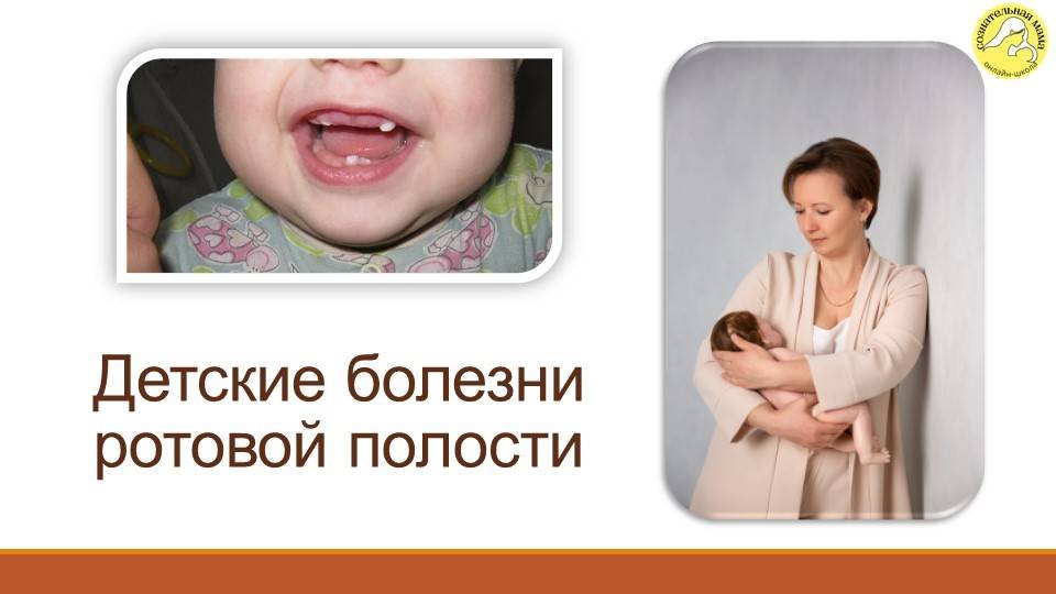 Детские болезни ротовой полости