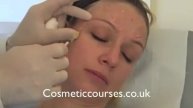 Botox training 3: Botox injection demonstration | Cosmetic Courses