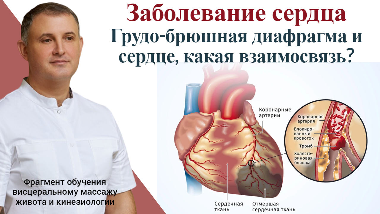 Заболевание сердца. Грудо-брюшная диафрагма и сердце, какая взаимосвязь? Фрагмент обучения