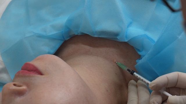 100% liquid form PCL Juvirose injection to neck wrinkles