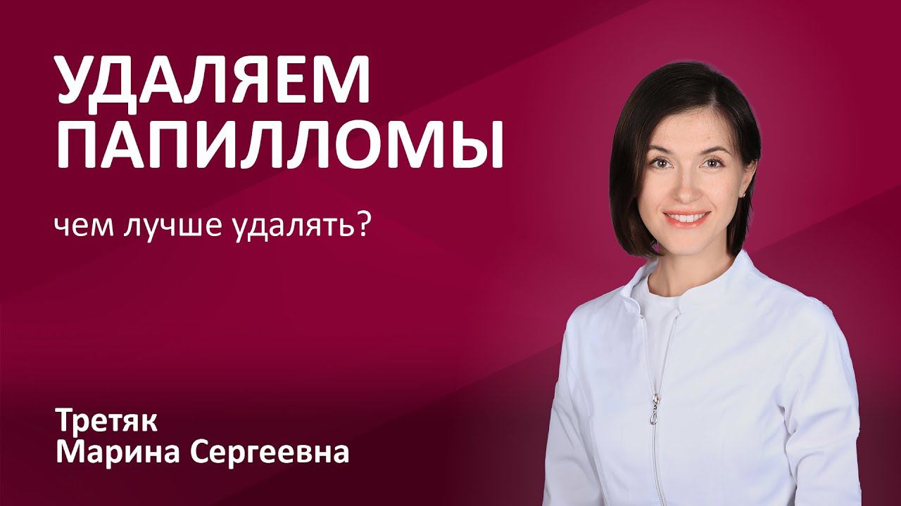 148.11 Как и чем удалять папилломы? Дерматолог Третяк Марина Сергеевна