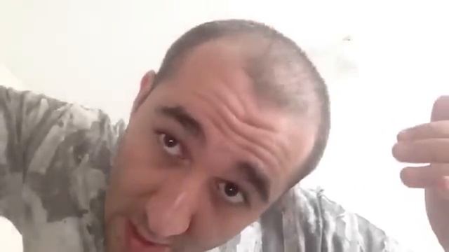 Как использовать Миноксидил Киркланд для мужчин.