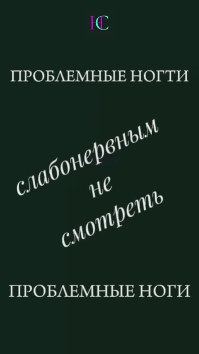 Слабонервным не смотреть.🚫
Проблемные ногти. Утолщенные ногти. Мозоли. Стопы.