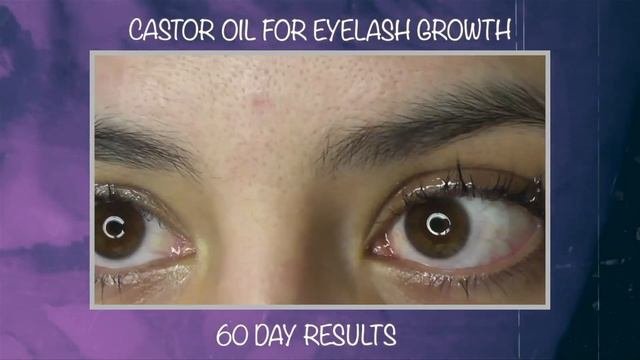 CASTOR OIL FOR EYELASHES | 6 MONTH RESULTS