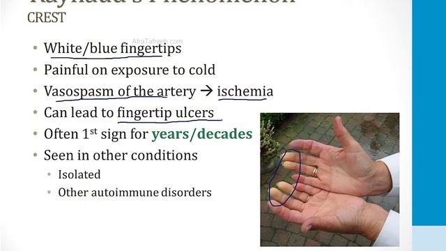 Immunology - 4. Autoimmune Disorders - 3.Scleroderma atf