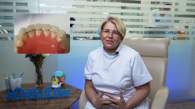 Мне уже поздно ставить брекеты! Мифы и правда от ортодонта со стажем 30 лет